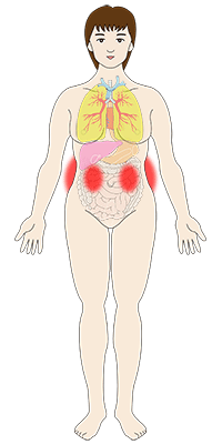 腎臓の関連痛