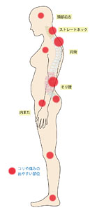 不良姿勢とコリや痛み